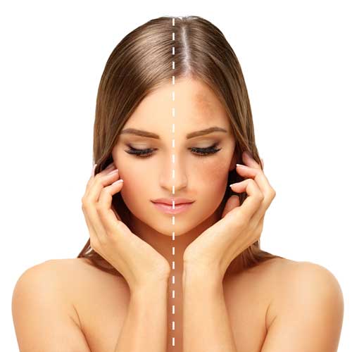 image of the Full Body Laser Toning treatment